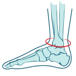 ankle-pain-zw-lower-and-lower-limb-3-1320x1320