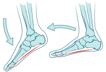 dropfoot-pain-foot-pain-zw-lower-and-lower-limb-3-1320x907