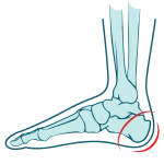 heel-pain-zw-lower-and-lower-limb-3-1320x1319