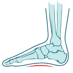 midfoot-pain-zw-lower-and-lower-limb-3-1320x1320