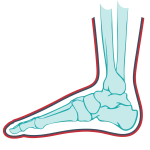 pain-on-the-outside-zw-lower-and-lower-limb-3-1320x1320