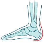 rearfoot-pain-zw-lower-and-lower-limb-3-1320x1319